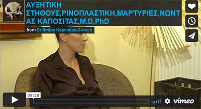 ρινοπλαστική