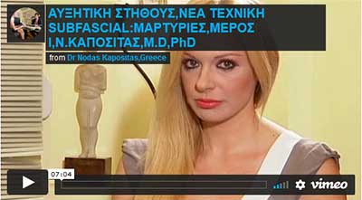 ρινοπλαστική